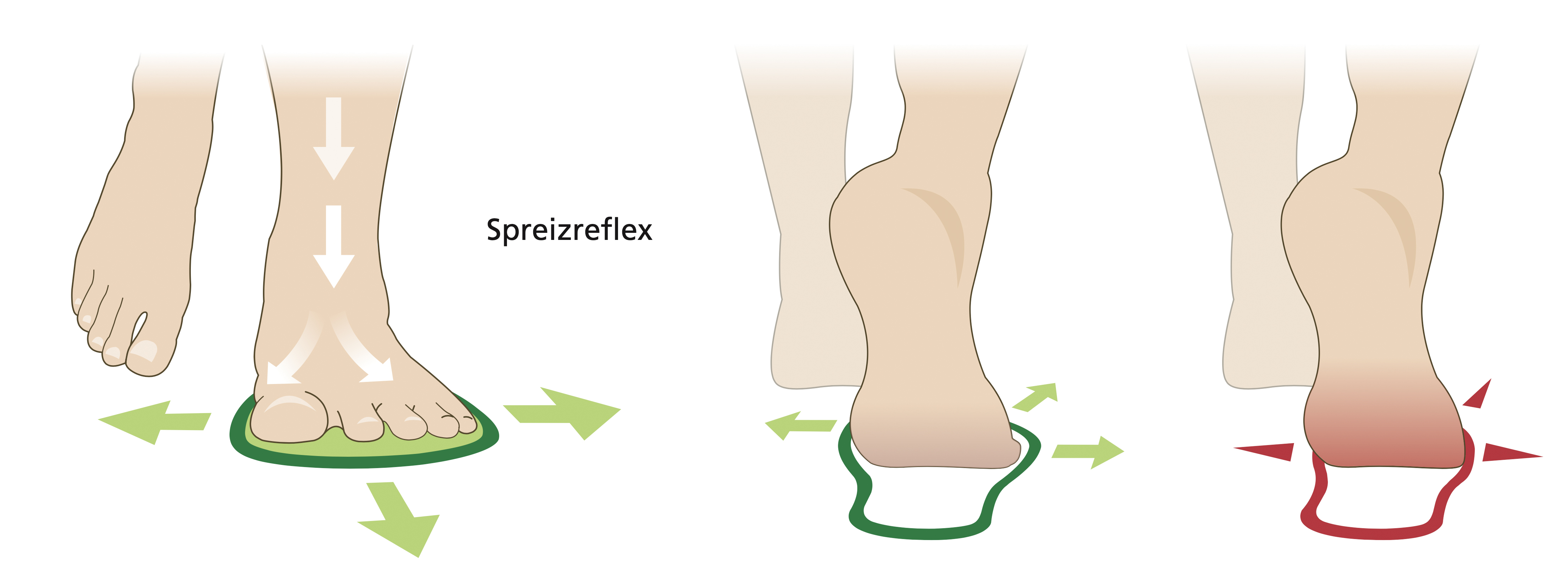 Illustration von Füßen mit Pfeilen zur Darstellung des Spreizreflexes des Fußes aus verschiedenen Perspektiven.
