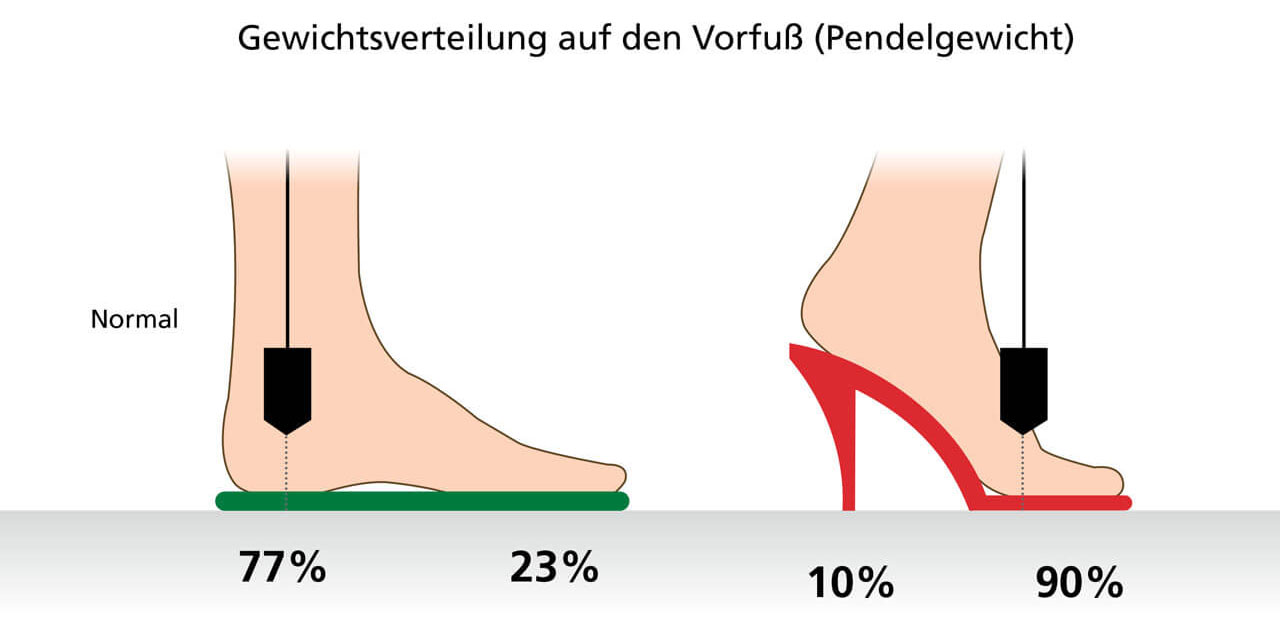 Illustration zeigt die Gewichtsverteilung auf den Vorfuß: 77% auf Ferse und 23% auf Ballen beim normalen Schuh, 10% auf Ferse und 90% auf Ballen beim High Heel